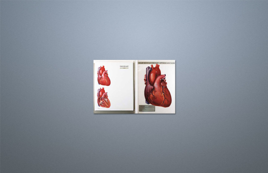 Pharmaceutical Sales Aid: Cover prints in metallic inks with blind embossing. Text pages print process on acetate overlays, registered to illustrate individual heart function systems